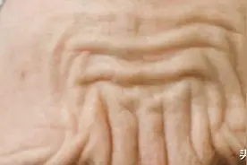 运势不顺、一生操劳？“暗藏玄机”的抬头纹，该如何解决图片