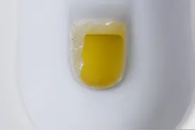 41岁男子小便发黄以为是上火，查出肾癌，医生：尿尿变这样是警告图片