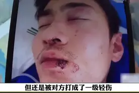 别人打你左脸，你应该把右脸伸出去让他再打一下！这样就对称了！图片