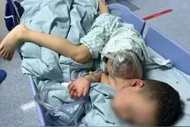 一个七岁的孩子，胳膊被爆竹完全炸断图片
