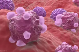 为什么女性“下面”会发臭、有异味？医生：多半是3个原因导致图片