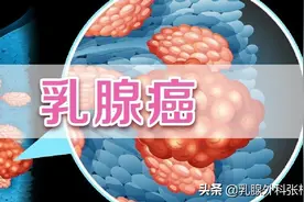 75%的乳腺癌转移为肺转移，到底是怎么回事？图片