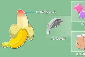 包皮龟头炎咋来的？包皮过长？私生活乱？龟头炎预防招数大放送图片