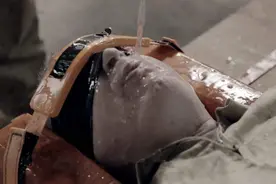 水滴头骨穿：西方残忍刑罚起了个中国名，为何会出现这样的情况？图片