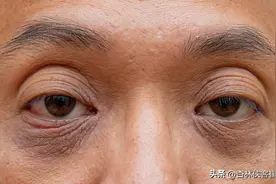 肾虚眼圈黑、脾虚眼袋大、肝火眼睛红，五脏哪不好，看眼睛就知道图片