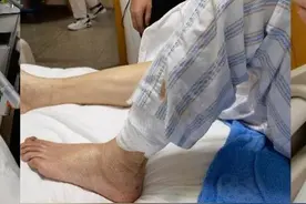 老人下肢无力口眼干燥 检查后竟是视神经脊髓炎谱系病伴干燥综合征图片