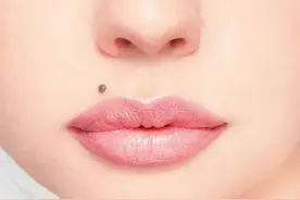 痣形成的原因？痣长毛、痣变多变大是痣病变？教你5招判别图片