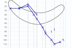 什么是低频、中频和高频？对听力有什么影响？图片
