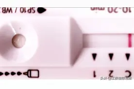 艾滋病，真的可怕吗？图片