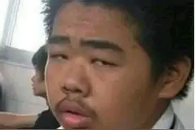 男人的胡须茂盛与什么有关？性功能还是寿命？医生给您科普图片