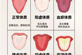 中医舌诊，观舌苔晓健康，常见6种舌象，一起来学学！图片