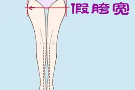 「假胯宽」怎么回事？正确的训练应该怎么做呢？2个动作搞定图片