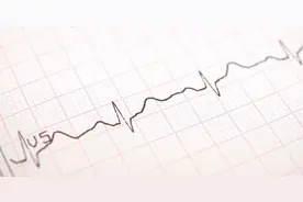 心电图不是躺着做吗？为何有人在跑步机和单车做心电检测？图片