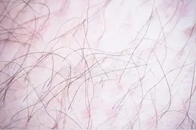 男人私处的毛毛应该怎样“打理”？修剪或剃毛时这几点你注意了吗图片