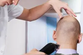 剃光头能让头发变多吗？图片