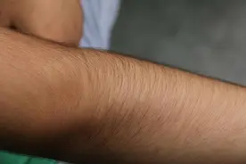 男人体毛旺盛，说明了什么？或与这2个因素有关，早知早受益图片