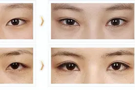 照镜子觉得自己好看，拍照却显丑！到底哪个才是真实的你？图片