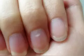 身体有病手指先知？提醒：警惕手指出现的7种变化，或是疾病来袭图片