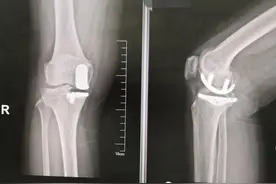 【门诊医讯】河北省人民医院骨科关节专业组 为您的关节保驾护航图片