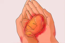 孕期出血的7种主要原因图片