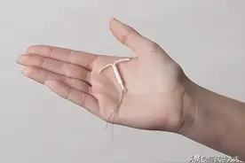 曼月乐能避孕更能治病图片