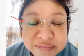 韩红确诊新冠形象大变，头发杂乱似鸡窝，身形消瘦嗓音受损变化大图片