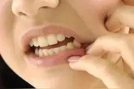牙痛得效方~本方以治肾固齿为要而统治各种牙痛。图片