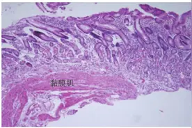 中国慢性胃炎诊治指南(2022年，上海)图片