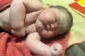 5.7公斤！新生巨婴太惊人图片