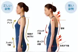 干货教程 /“背太厚”单单是因为脂肪太多？图片