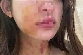 女子牵狗进电梯，遭一对夫妇扯衣致胸部裸露？当地妇联：如有需要会提供帮助，律师：这是互殴！图片