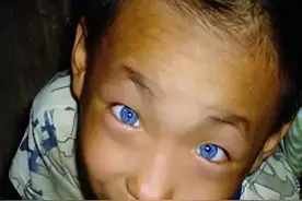 广西一男童天生拥有蓝眼,夜晚看东西如同白天,检查结果让全家沉默图片