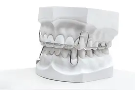 骨性龅牙和牙性龅牙差别在哪里？图片