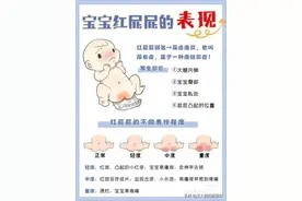 导致宝宝红屁股的原因红屁股怎么办图片