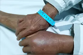 广西72岁老汉被2米“过山风”咬伤！到底有多毒？不怕雄黄怕什么图片