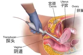 助您好孕——B超监测排卵不可不知道的细节图片