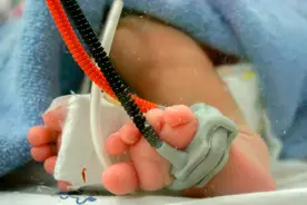 截掉20厘米肠子，娃才保住命！肠套叠怕拖，24小时不治可能会断肠图片