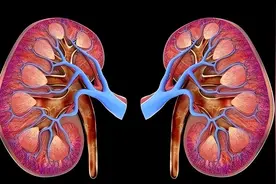 尿蛋白3+ 慢性肾炎图片