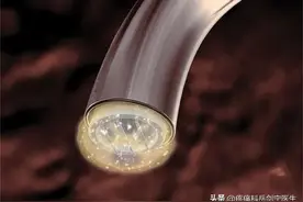 揭秘椎间盘突出微创治疗利器“低温等离子射频消融”图片