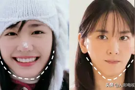 女明星也避免不了牙套脸！元气满满的宅男女神颜值跌下神坛图片