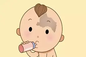 胎记形成的原因？图片