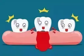 刷牙出血真的是因为“上火”吗？图片