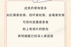 脸上长痘痘，反复发作很苦恼？一次性介绍6种药，总有一款适合你图片
