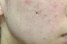 为什么刚洗完脸很白，过一会儿就黄了？图片