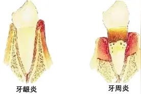 关于替硝唑，你至少需要知道这5点！图片