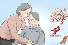 经常手脚发“麻”的人，可能是这6种病在找你“麻”烦图片