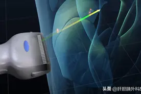 一文读懂肝脏的B超报告图片