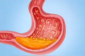 胃不好能吃什么水果？消化科：这3种水果或可多吃，对胃有益图片