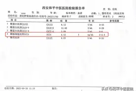 体检发现肿瘤标志物升高，是身体有癌吗？图片