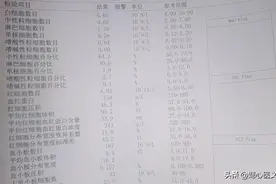 体检单中常见缩写的意思！图片